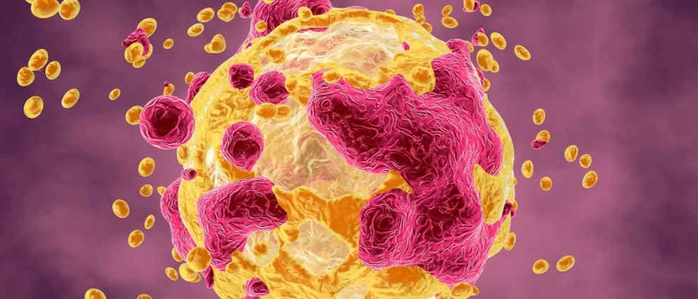 "Könnte viel Leid ersparen": Neuer Krebstest sagt Erfolg von Chemotherapien voraus